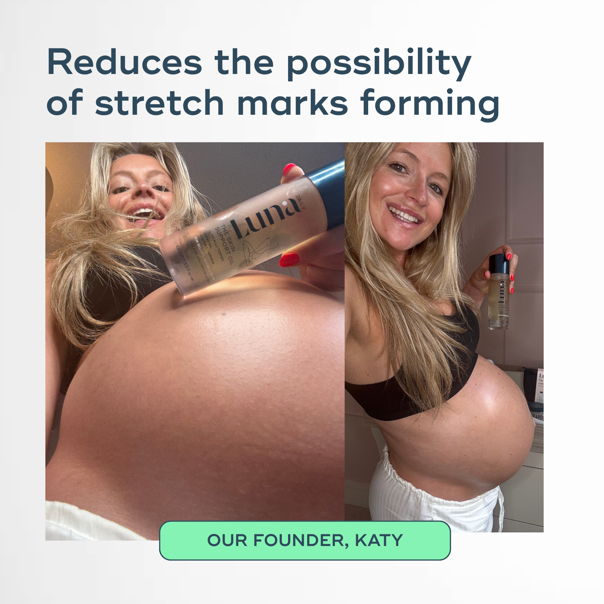 The Skin Support Oil - For Stretch Marks