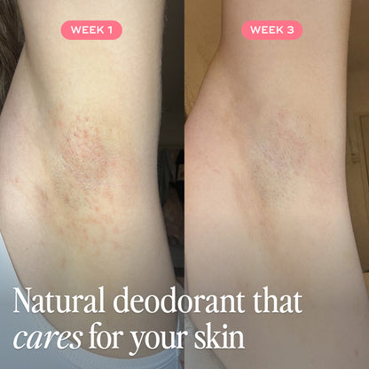 The All Over Deodorant™- Hydrating Soft Cotton