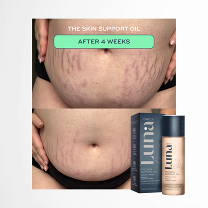 The Skin Support Oil - For Stretch Marks