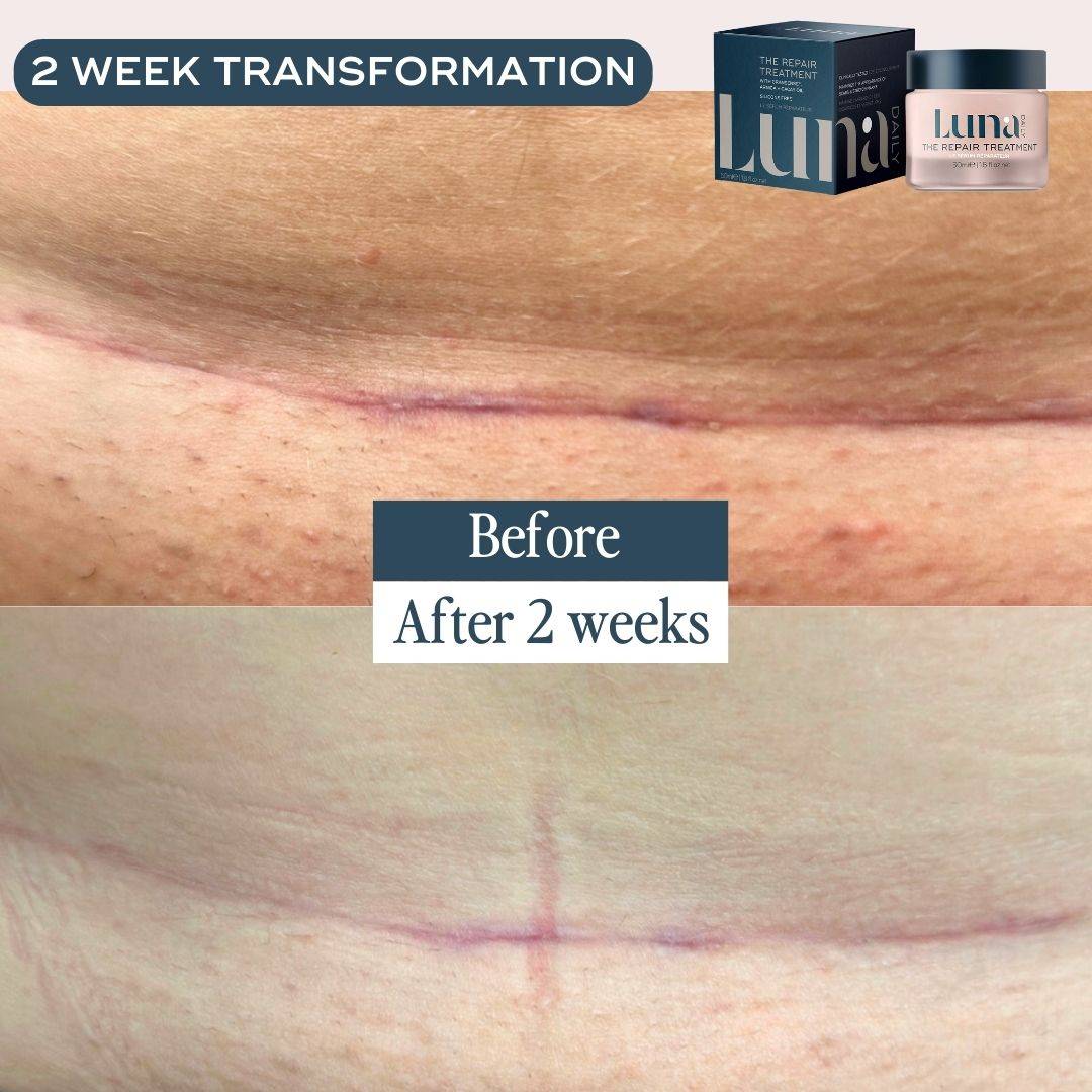 THE REPAIR TREATMENT - Luna Daily - #