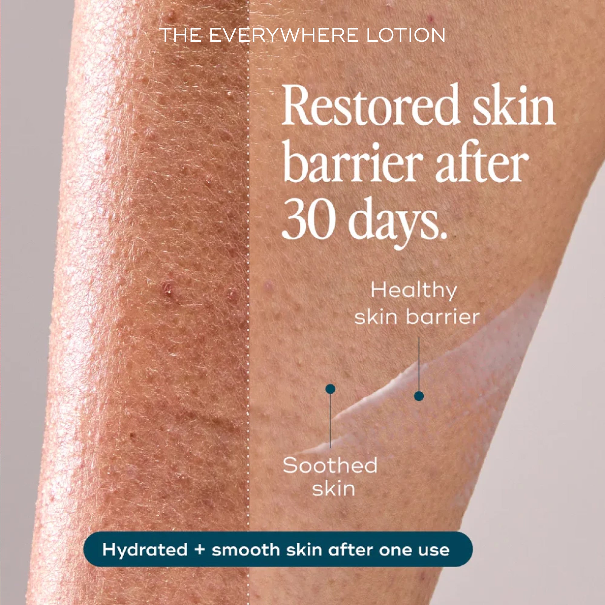 Smooth Skin Saviours - Rid Ingrowns, Redness + Bumps in 2 weeks (+ FREE Lotion worth $26)